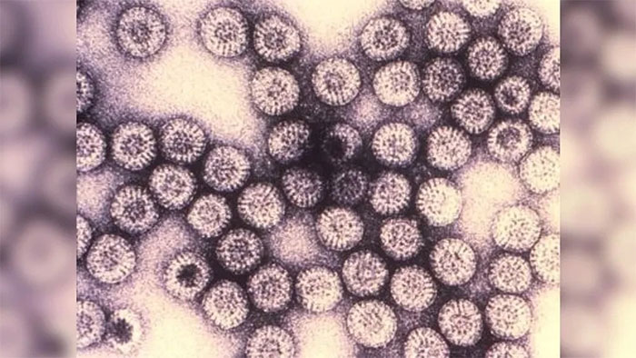 Rotavirus là tác nhân khiến nhiều trẻ em tử vong vì tiêu chảy.