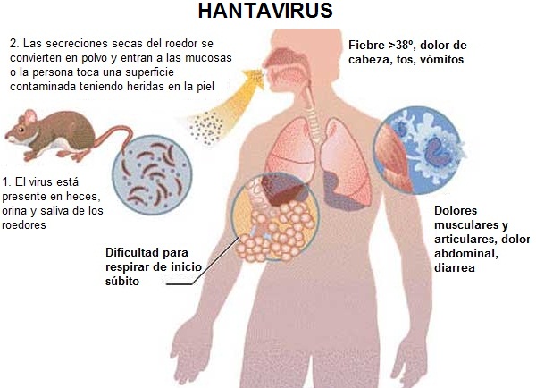 Virus Hanta