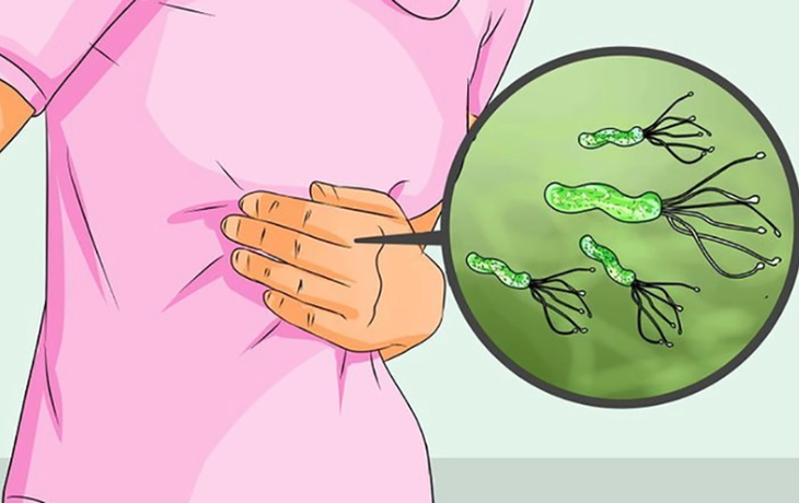 Vi khuẩn HP gây viêm nhiễm và đau dạ dày - Ảnh minh họa