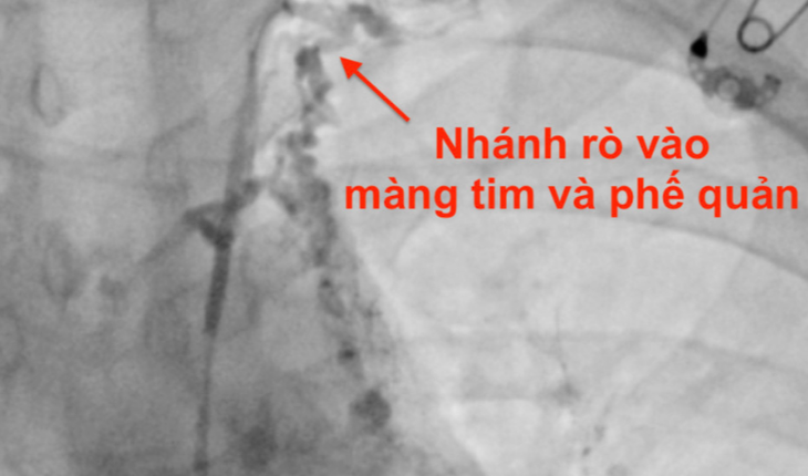 Hình ảnh chụp tim, phế quản của bệnh nhân - Ảnh: Bệnh viện cung cấp