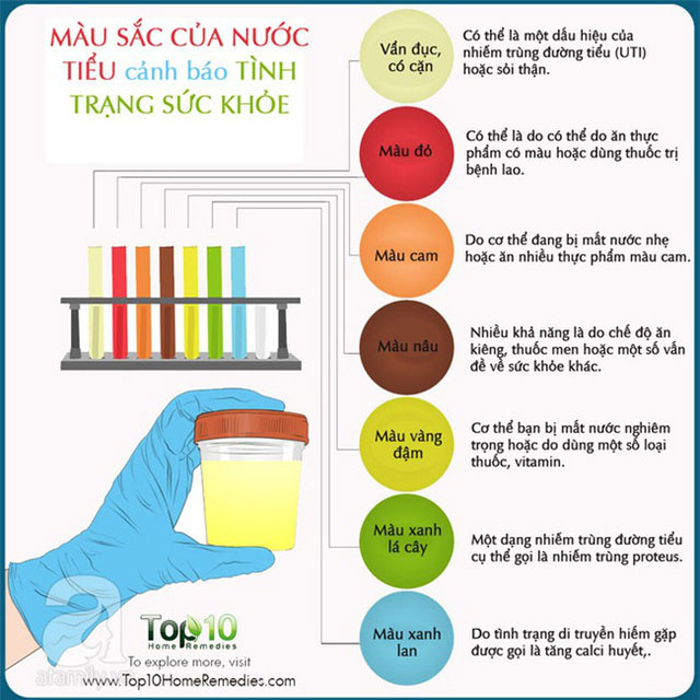 Chẩn đoán bệnh qua nước tiểu