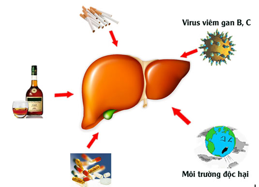 Các nguyên nhân gây bệnh xơ gan