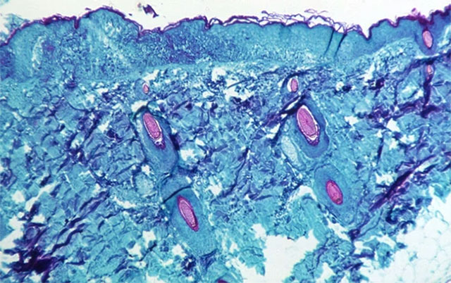 Virus bệnh đậu khỉ xâm nhập tế bào.